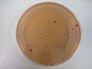 大腸菌群集落（コロニー）例の写真