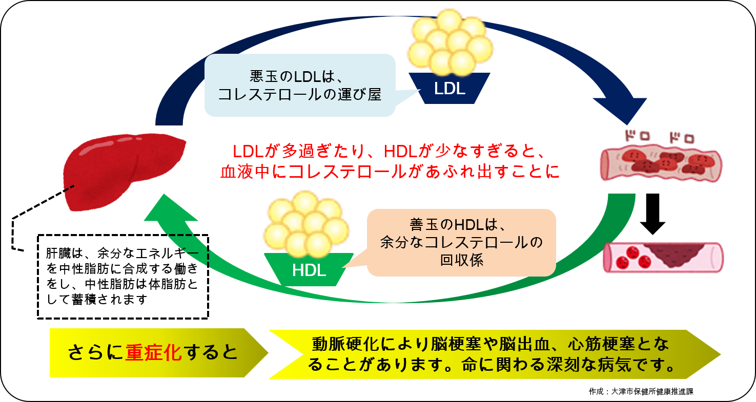 高脂血症について