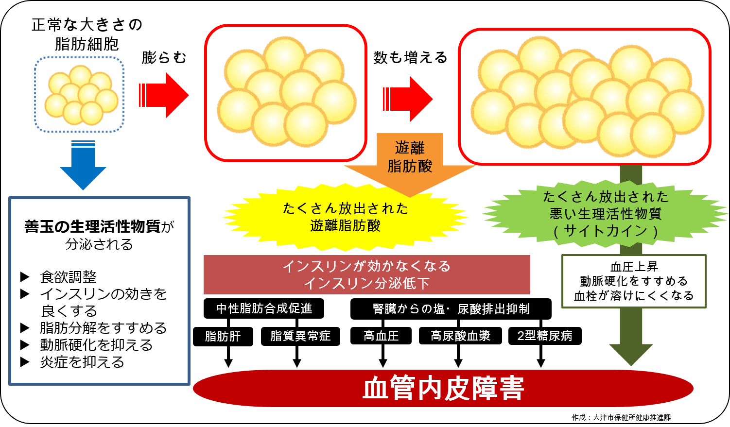 内臓脂肪が増えることの影響